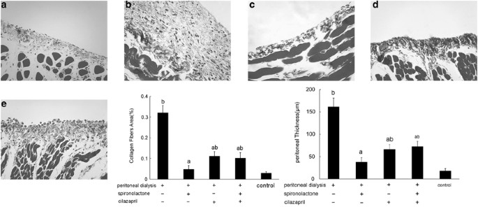 The Aldosterone Receptor Antagonist Spironolactone Prevents