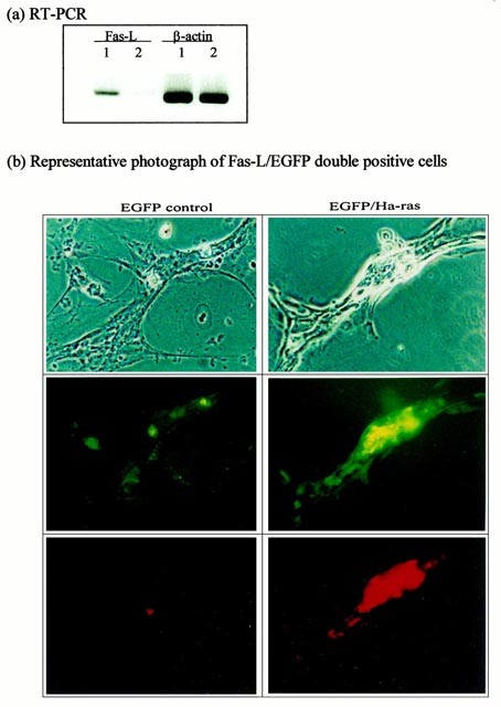 Ras Signaling Is Involved In The Expression Of Fas L In Glioma Laboratory Investigation