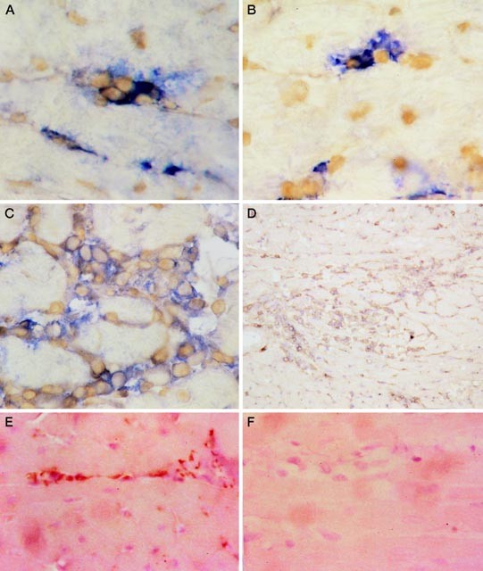 Critical Role for Monocyte Chemoattractant Protein-1 and Macrophage  Inflammatory Protein-1α in Induction of Experimental Autoimmune Myocarditis  and Effective Anti–Monocyte Chemoattractant Protein-1 Gene Therapy