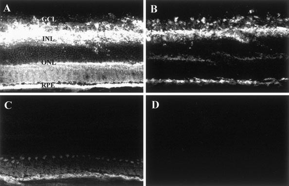 Preclinical Evaluation of a Phosphorothioate Oligonucleotide in the Retina  of Rhesus Monkey | Laboratory Investigation