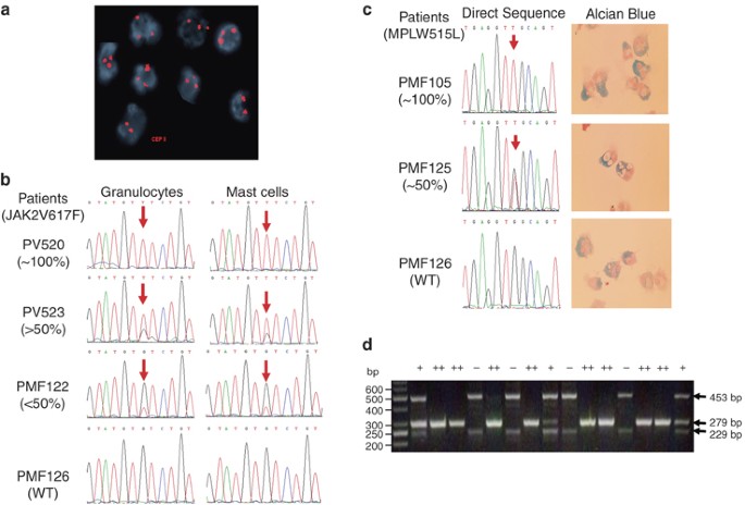 Involvement Of Mast Cells By The Malignant Process In Patients With Philadelphia Chromosome Negative Myeloproliferative Neoplasms Leukemia