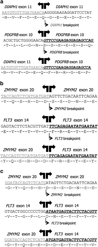 Cytogenetically Cryptic Zmym2 Flt3 And Diaph1 Pdgfrb Gene Fusions In Myeloid Neoplasms With Eosinophilia Leukemia