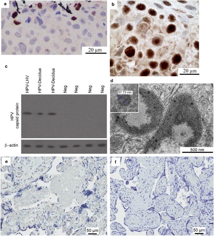 hpv-terápia nedir