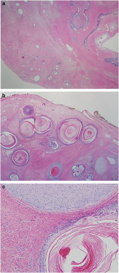 figure 17