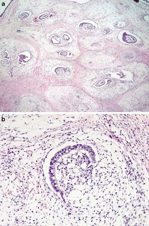 figure 20