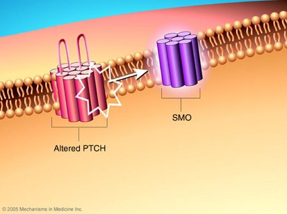 figure 17