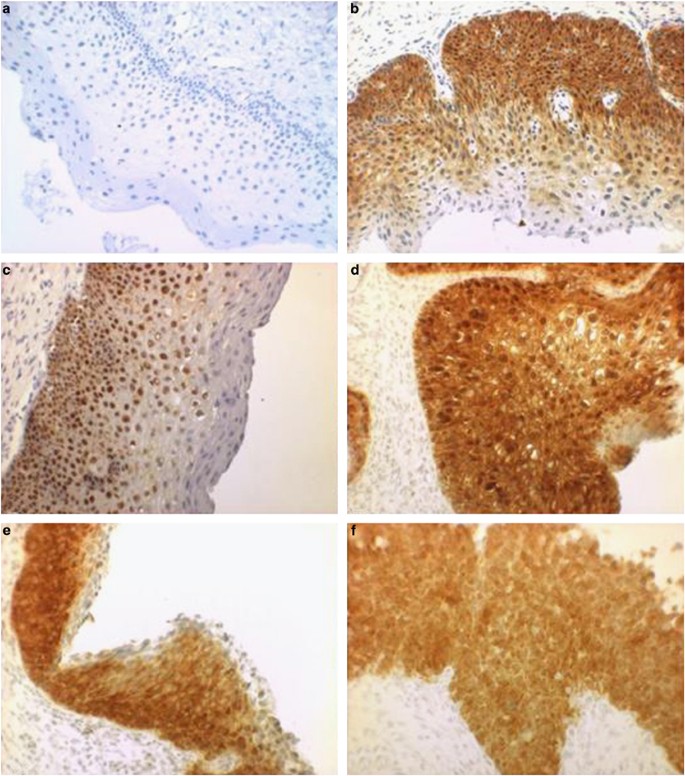 Human papillomavirus p16 staining,