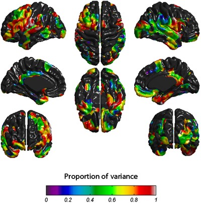 Childhood Cognitive Ability Accounts For Associations Between Cognitive Ability And Brain Cortical Thickness In Old Age Molecular Psychiatry