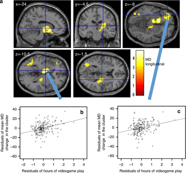 Impact Of Videogame Play On The Brain S Microstructural Properties Cross Sectional And Longitudinal Analyses Molecular Psychiatry