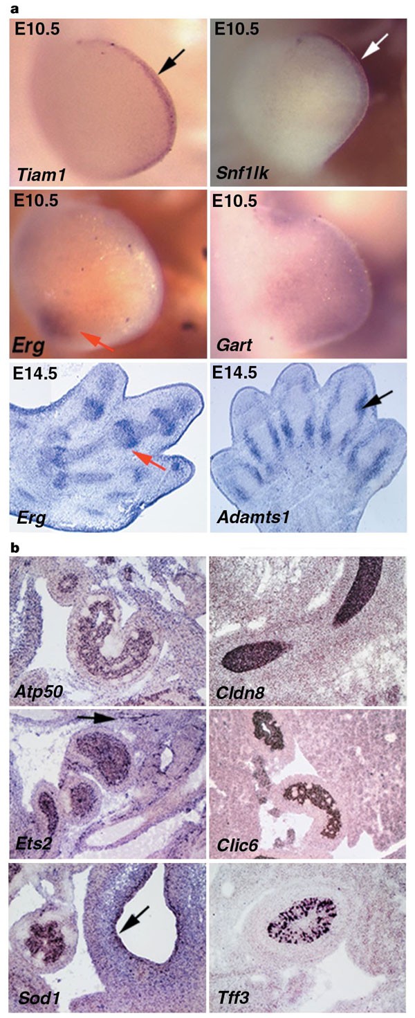 Figure 4: Expression analysis in the developing limb and gastrointestinal tract.