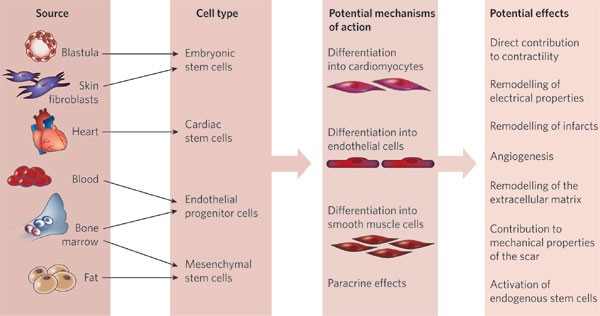 
Is stem cell therapy right for Atherosclerosis with stem cells? thumbnail