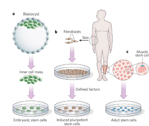 figure1