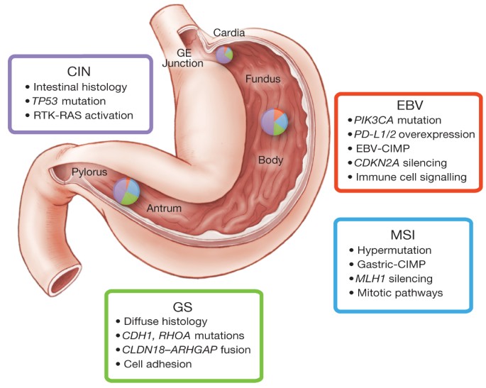 gastric cancer molecular subtypes hpv nemi szemolcs kezelese