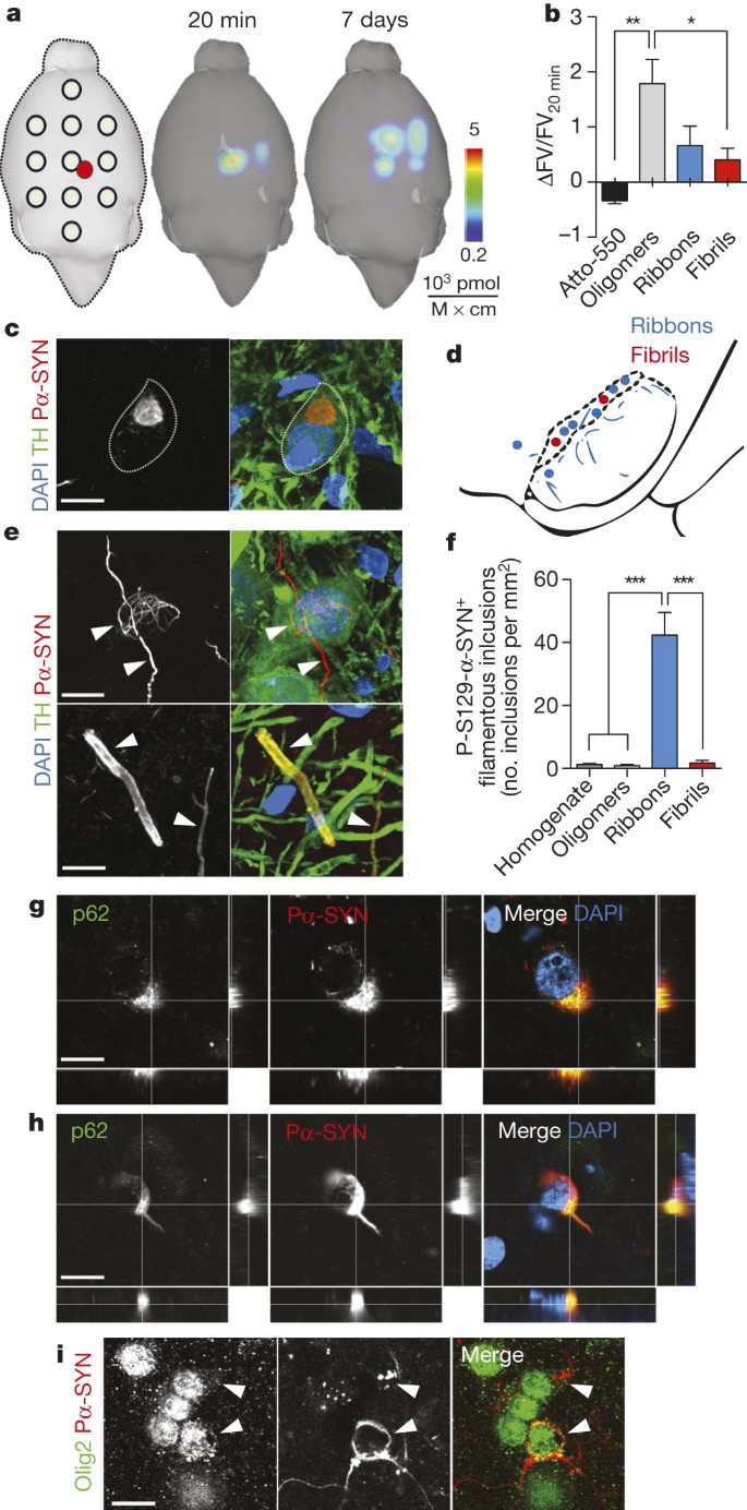 α-Synuclein strains cause distinct synucleinopathies after local and  systemic administration | Nature