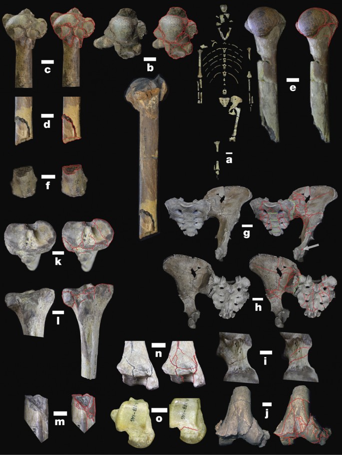 Perimortem Fractures In Lucy Suggest Mortality From Fall Out Of Tall Tree Nature