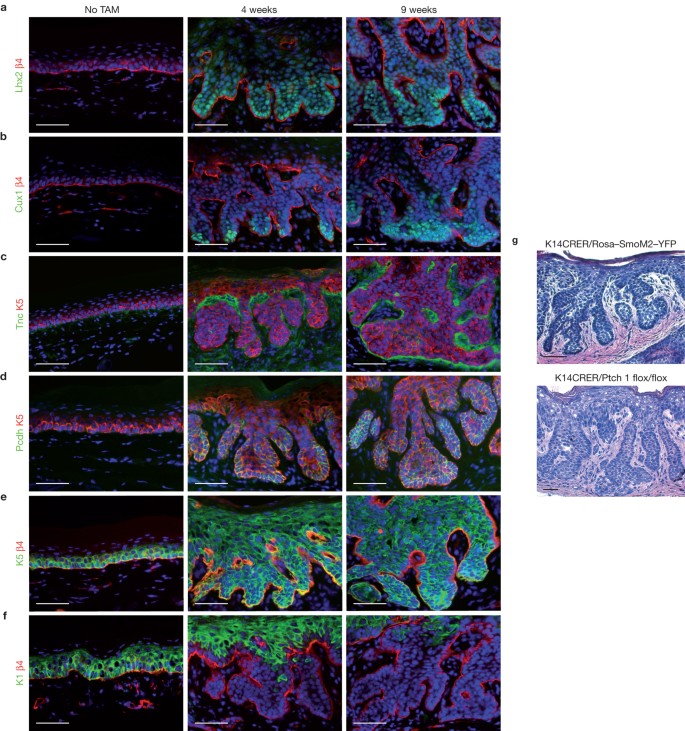 Adult interfollicular tumour-initiating cells are reprogrammed 