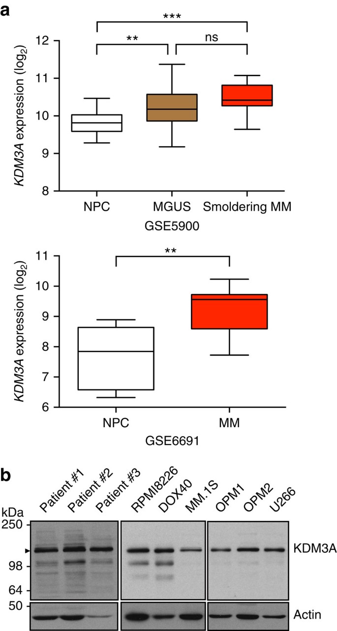 Figure 1: KDM3A expression in MM cells.