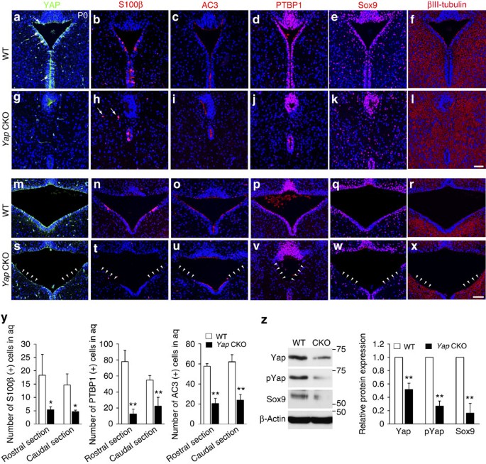 Figure 2: The apical integrity of ventral aqueduct is compromised in the absence of Yap.