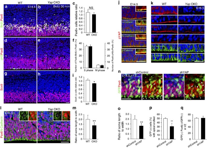 Figure 6: Yap loss causes defects in cell shape and apical attachment of cortical progenitors.