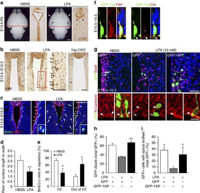 Figure 7: Forced Yap expression reverses LPA-induced cellular defects.