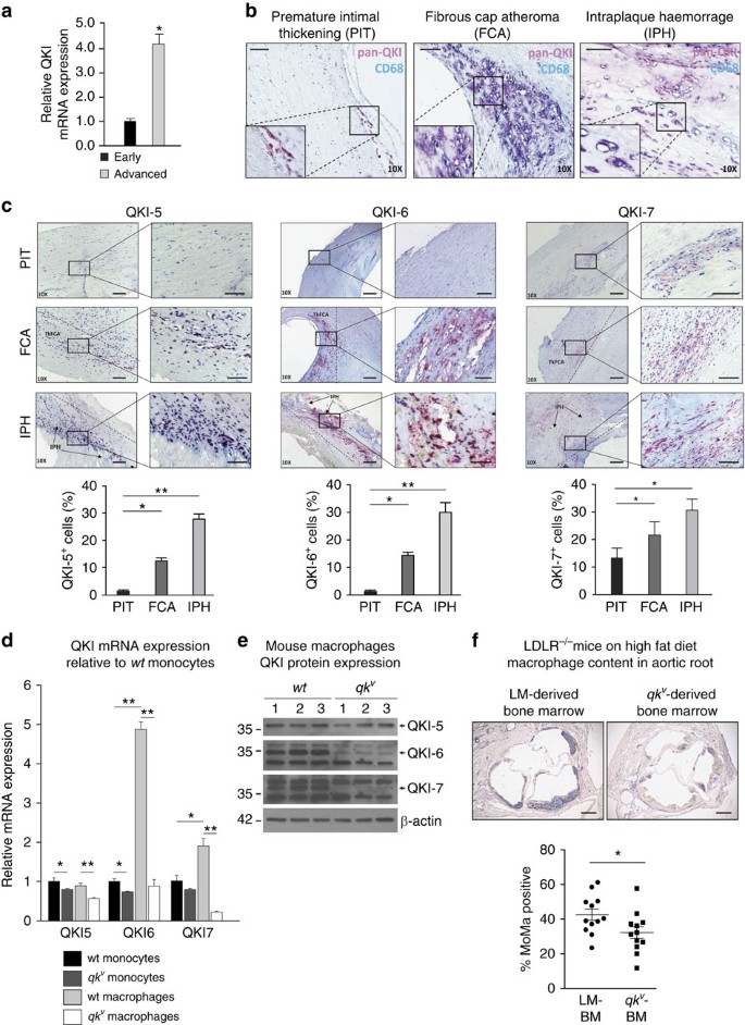 Quaking Promotes Monocyte Differentiation Into Pro Atherogenic Macrophages By Controlling Pre Mrna Splicing And Gene Expression Nature Communications Quaking Promotes Monocyte Differentiation Into Pro Atherogenic Macrophages By Controlling Pre Mrna Splicing And Gene Expression Nature Communications