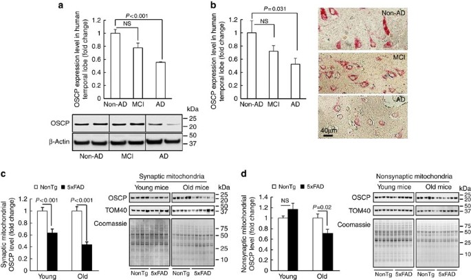 itochondrial F1FO-ATP synthase via OSCP in A