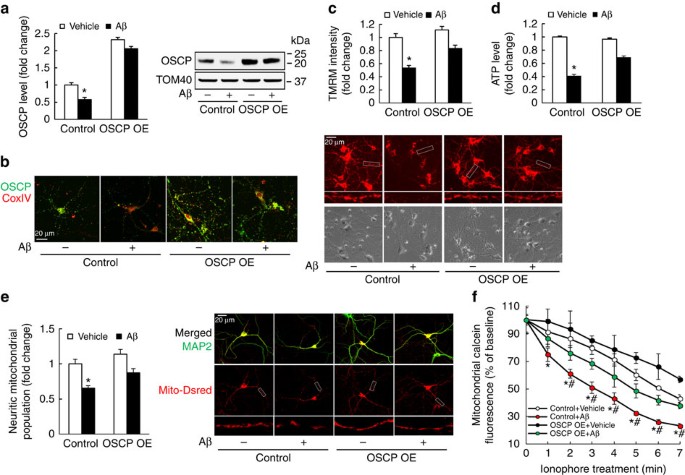 itochondrial F1FO-ATP synthase via OSCP in A