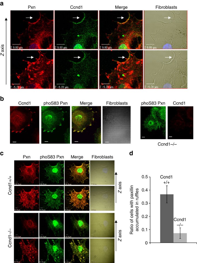 Figure 5: Ccnd1 co-localizes with Pxn in membrane ruffles of fibroblasts and tumour cells.