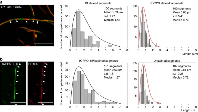 Figure 5: Confocal laser scanning fluorescence microscopy analysis of the ftsZ mutant HU133.