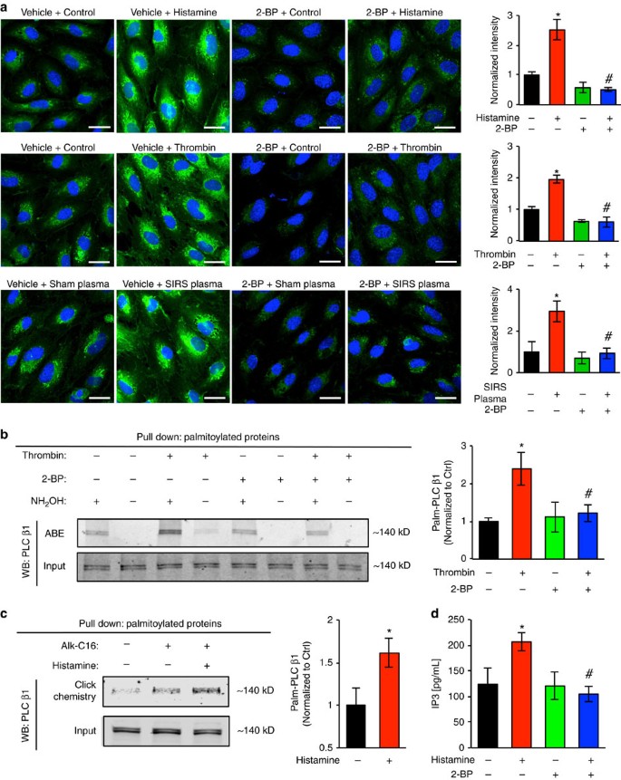 Palmitoyl acyltransferase DHHC21 mediates endothelial dysfunction in  systemic inflammatory response syndrome | Nature Communications