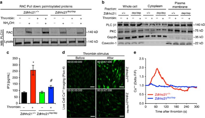Palmitoyl acyltransferase DHHC21 mediates endothelial dysfunction in  systemic inflammatory response syndrome | Nature Communications