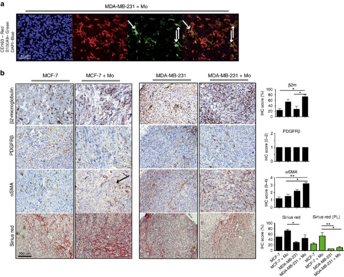 Figure 2: IHC of xenografts.