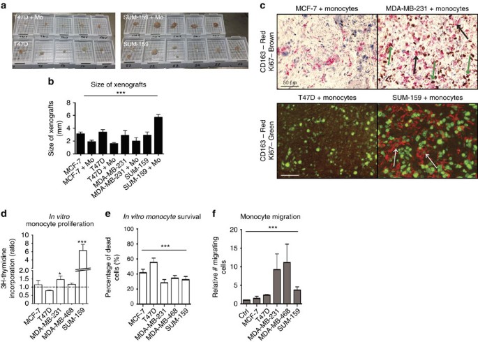 Figure 3: Characterization of primary monocytes in TNBC cultures.