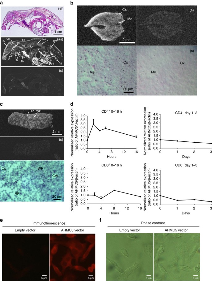 Armc5 Deletion Causes Developmental Defects And Compromises T Cell Immune Responses Nature Communications