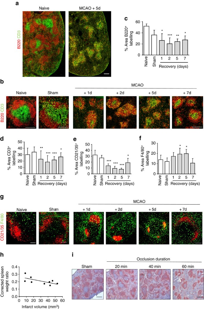 Adrenergic Mediated Loss Of Splenic Marginal Zone B Cells Contributes To Infection Susceptibility After Stroke Nature Communications