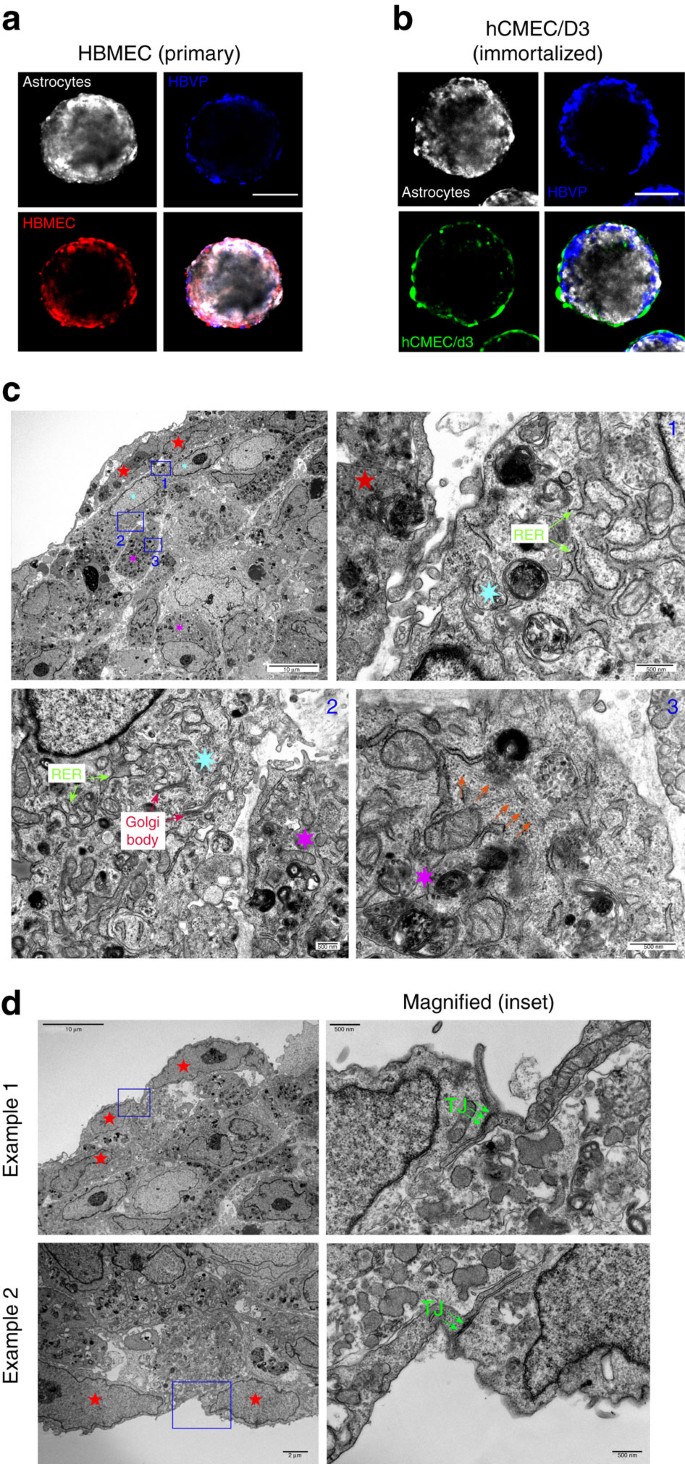 Blood-brain-barrier spheroids as an in vitro screening platform for  brain-penetrating agents | Nature Communications