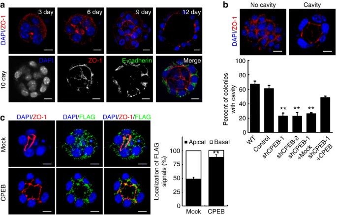 Cpeb Mediated Zo 1 Mrna Localization Is Required For Epithelial Tight Junction Assembly And Cell Polarity Nature Communications Cpeb Mediated Zo 1 Mrna Localization Is Required For Epithelial Tight Junction Assembly And Cell Polarity Nature Communications