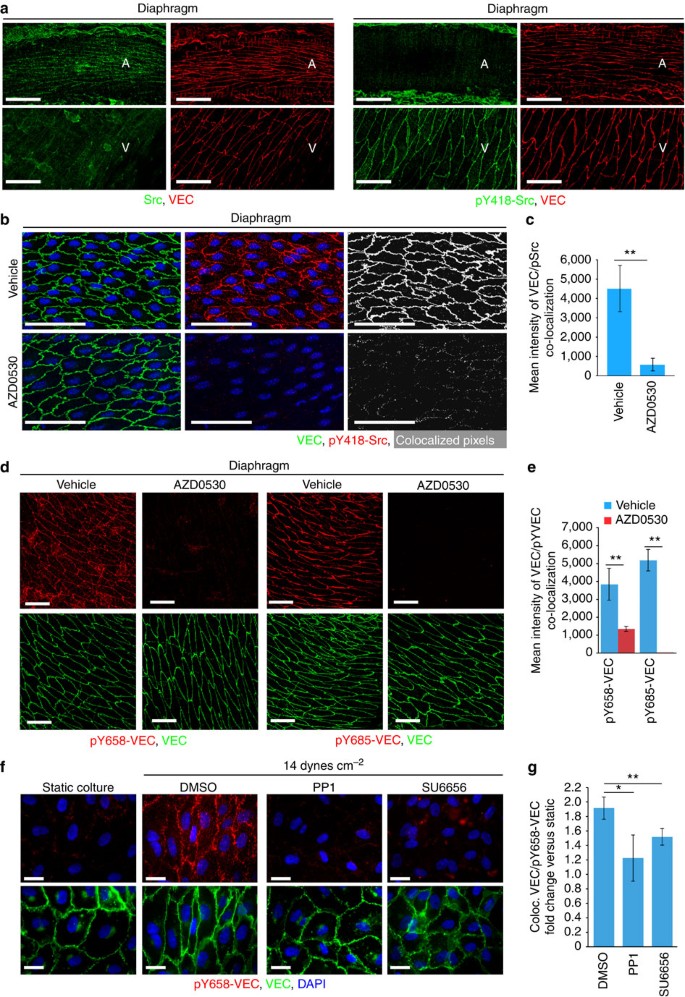 Phosphorylation Of Ve Cadherin Is Modulated By Haemodynamic Forces And Contributes To The Regulation Of Vascular Permeability In Vivo Nature Communications