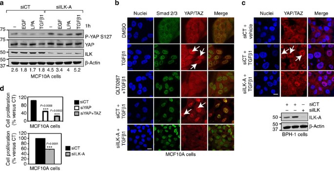 Figure 3: ILK is required for growth factor-mediated inactivation of the Hippo pathway.