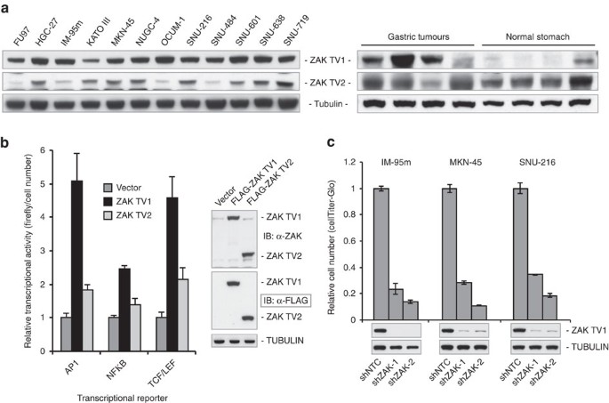 Figure 4: Experimental validation of ZAK function in cancer.