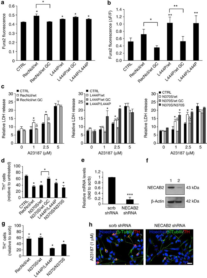 iPSC-derived neurons from GBA1-associated Parkinson's disease patients show  autophagic defects and impaired calcium homeostasis | Nature Communications