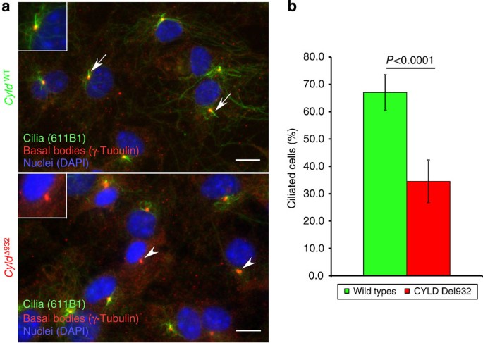 Figure 3: CYLDΔ932 affects primary cilia formation.