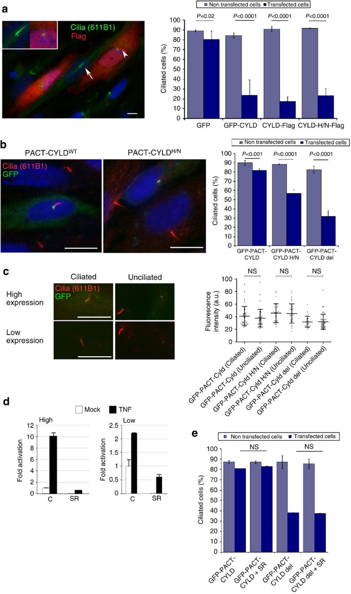 Figure 8: Regulation of primary cilium formation by CYLD in an NF-κB-independent manner.