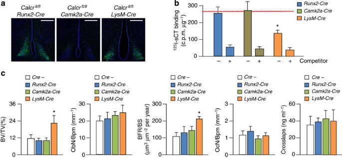 Figure 3: Control of bone formation by the CTR in osteoclasts.