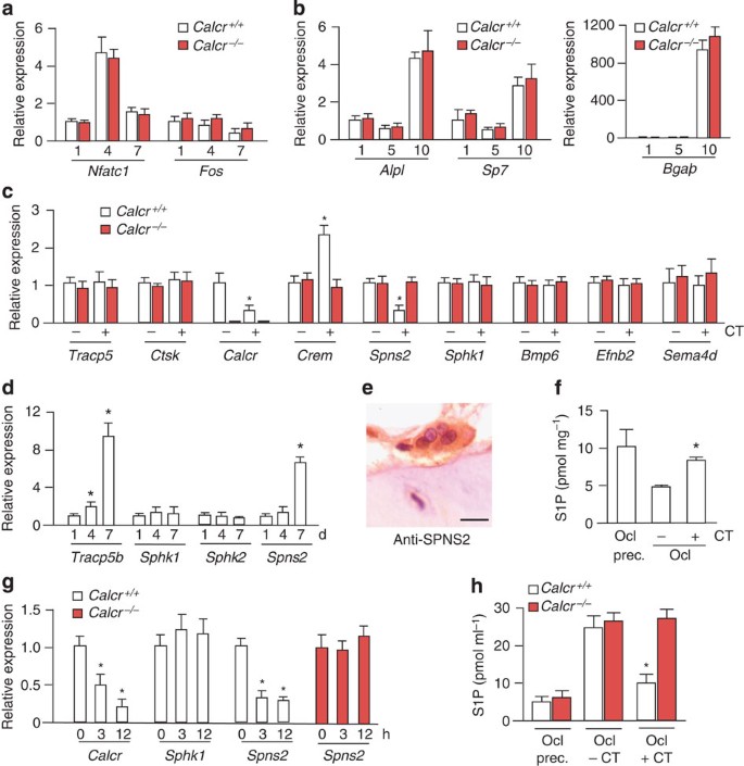 Figure 4: CT inhibits S1P release from osteoclasts.