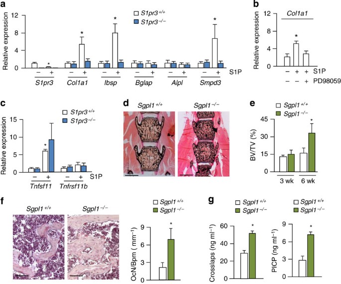 Figure 6: S1P affects gene expression in osteoblasts and accelerates bone turnover.