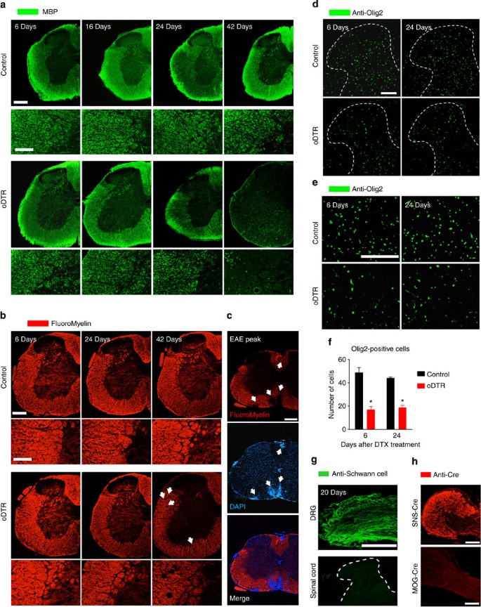 Figure 4: Analysis of changes in myelination in the spinal cord upon oligodendrocyte ablation (oDTR) after administration of diphtheria toxin (DTX) and potential modulatory factors.
