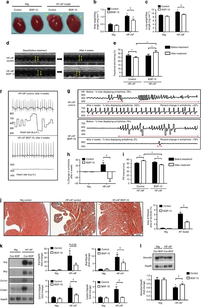 The Small Molecule Bgp 15 Protects Against Heart Failure And Atrial Fibrillation In Mice Nature Communications