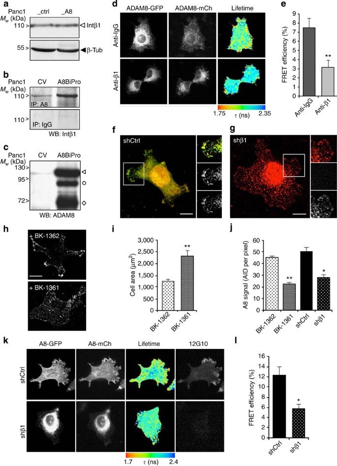 Figure 4: ADAM8 multimerizes and interacts with integrin β1 in tumour cells.