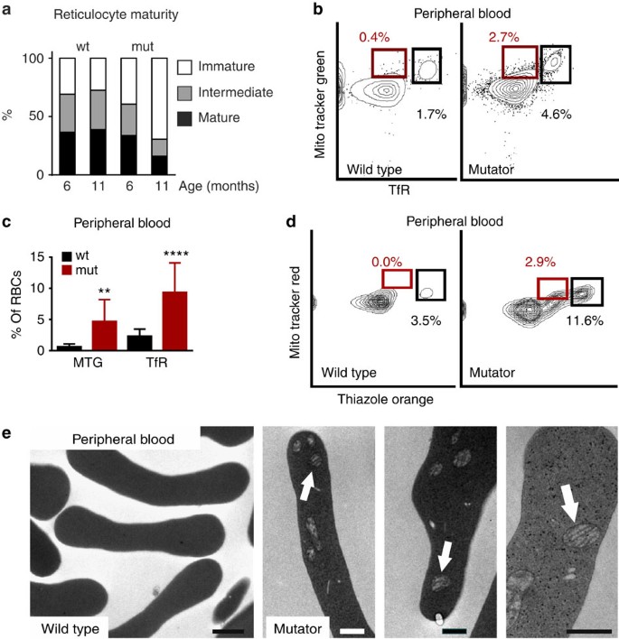 MtDNA mutagenesis impairs elimination of mitochondria during erythroid  maturation leading to enhanced erythrocyte destruction | Nature  Communications